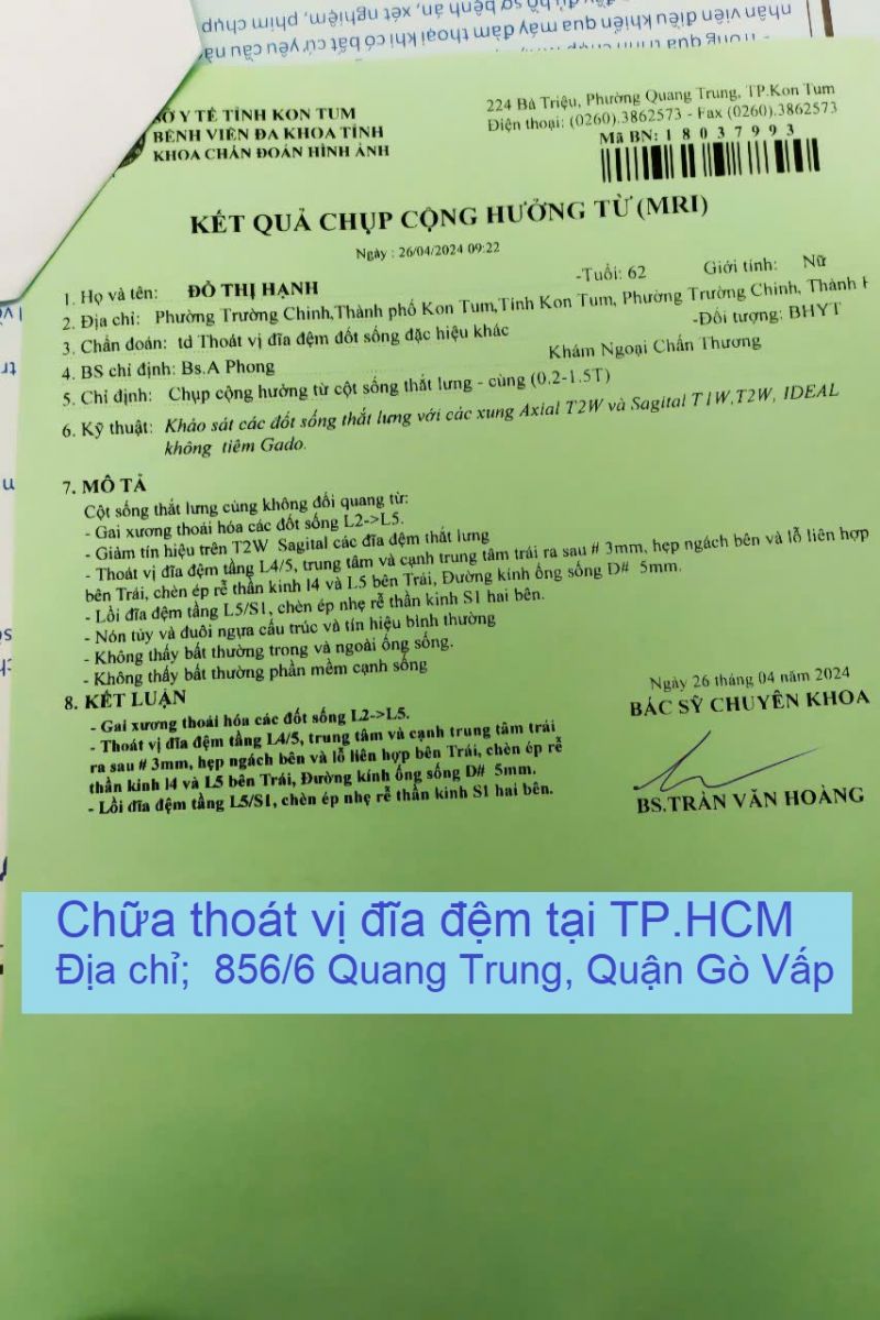 Thoát vị đĩa đệm L4 L5